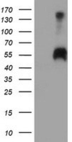 SPINT1 Mouse anti-Human, Clone: OTI4E3, lyophilized, TrueMAB 100 &mu;g;