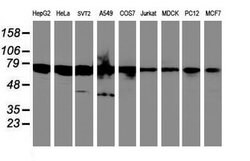 SPINT1 Mouse anti-Canine, Human, Mouse, Rat, Clone: OTI4H2, lyophilized,