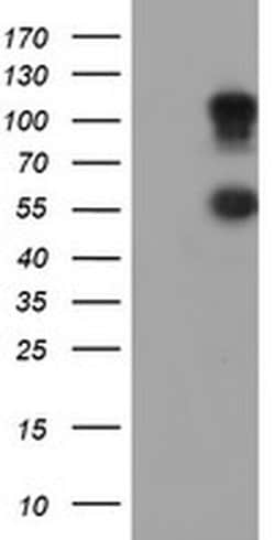 SPINT1 Monoclonal Antibody (OTI4E1), TrueMAB , OriGene 100 &mu;L; Unconjugated:Antibodies,