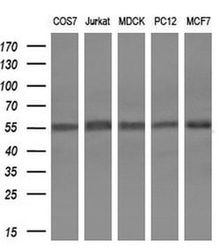 SPINT1 Monoclonal Antibody (OTI1E2), TrueMAB , OriGene 100 &mu;L; Unconjugated:Antibodies,