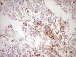 SPP1 Monoclonal Antibody (OTI5E4), TrueMAB , OriGene 100 &mu;L; Unconjugated:Antibodies,