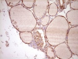 SPP1 Monoclonal Antibody (OTI5E4), TrueMAB , OriGene 100 &mu;L; Unconjugated:Antibodies,