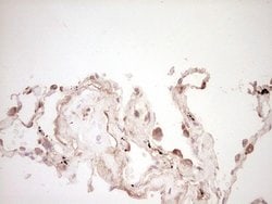 SPP1 Monoclonal Antibody (OTI5E4), TrueMAB , OriGene 100 &mu;L; Unconjugated:Antibodies,