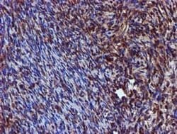 SPR Monoclonal Antibody (OTI2C6), TrueMAB , OriGene 30 &mu;L; Unconjugated:Antibodies,