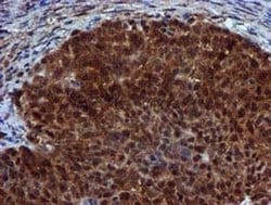 SPR Monoclonal Antibody (OTI2C6), TrueMAB , OriGene 30 &mu;L; Unconjugated:Antibodies,