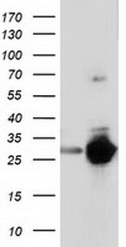SPR Mouse anti-Human, Clone: OTI3D6, liquid, TrueMAB 100 &mu;L; Unconjugated:Antibodies,