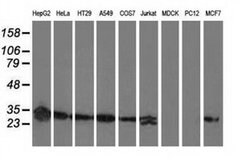 SPR Mouse anti-Human, Clone: OTI3D6, liquid, TrueMAB 100 &mu;L; Unconjugated:Antibodies,