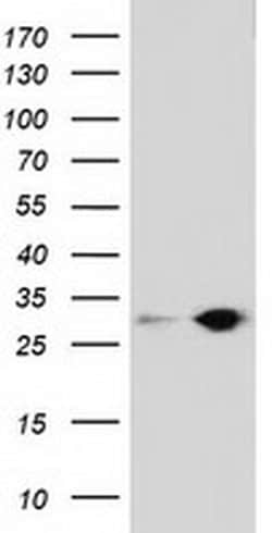 SPR Monoclonal Antibody (OTI3A9), TrueMAB , OriGene 30 &mu;L; Unconjugated:Antibodies,