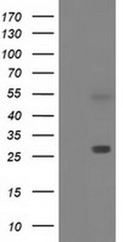 SPR Monoclonal Antibody (OTI3E3), TrueMAB , OriGene:Antibodies:Primary