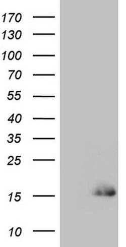 SPRR2A Monoclonal Antibody (OTI1B1), TrueMAB , OriGene 100 &mu;L; Unconjugated:Antibodies,