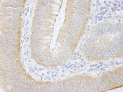 SPTAN1/Alpha II-spectrin Polyclonal Antibody, Bethyl Laboratories 10 &mu;L;