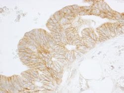 SPTAN1/Alpha II-spectrin Polyclonal Antibody, Bethyl Laboratories 10 &mu;L;