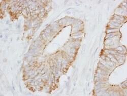 SPTBN1 Rabbit anti-Human, Mouse, Polyclonal, Bethyl Laboratories 100 &mu;l;
