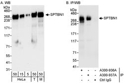 SPTBN1 Rabbit anti-Human, Mouse, Polyclonal, Bethyl Laboratories 100 &mu;l;