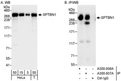 SPTBN1 Rabbit anti-Human, Polyclonal, Bethyl Laboratories 100 &mu;L; Unconjugated:Antibodies,
