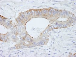 SPTBN1 Polyclonal Antibody, Bethyl Laboratories:Antibodies:Primary Antibodies