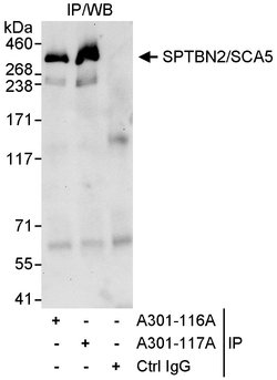 SPTBN2/SCA5 Rabbit anti-Human, Polyclonal, Bethyl Laboratories 100 &mu;L;