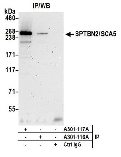 SPTBN2/SCA5 Rabbit anti-Human, Polyclonal, Bethyl Laboratories 100 &mu;L;