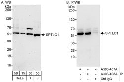 SPTLC1 Rabbit anti-Human, Polyclonal, Bethyl Laboratories 100 &mu;L | Buy Online | Bethyl Laboratories, Inc | Fisher Scientific