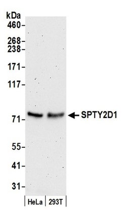 SPTY2D1 Polyclonal Antibody, Bethyl Laboratories 20 &mu;L | Buy Online | Bethyl Laboratories, Inc | Fisher Scientific