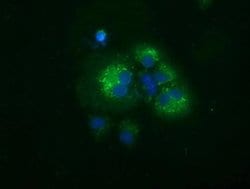 SQSTM1 Monoclonal Antibody (OTI1E9), TrueMAB , OriGene:Antibodies:Primary