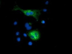 SQSTM1 Mouse anti-Human, Clone: OTI5A2, lyophilized, TrueMAB 100 &mu;g;