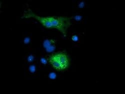 SQSTM1 Monoclonal Antibody (OTI5A2), TrueMAB , OriGene:Antibodies:Primary