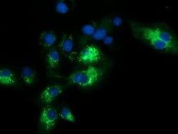 SQSTM1 Mouse anti-Human, Clone: OTI4C8, lyophilized, TrueMAB 100 &mu;g;