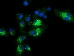 SQSTM1 Monoclonal Antibody (OTI4C8), TrueMAB , OriGene 100 &mu;L; Unconjugated:Antibodies,