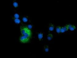 SQSTM1 Monoclonal Antibody (OTI7F6), TrueMAB , OriGene 100 &mu;L; Unconjugated:Antibodies,