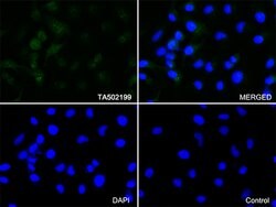 SQSTM1 Monoclonal Antibody (OTI1B2), TrueMAB , OriGene 100 &mu;L; Unconjugated:Antibodies,