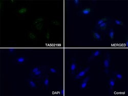 SQSTM1 Monoclonal Antibody (OTI1B2), TrueMAB , OriGene 100 &mu;L; Unconjugated:Antibodies,