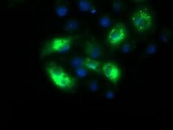 SQSTM1 Monoclonal Antibody (OTI6A7), TrueMAB , OriGene 100 &mu;L; Unconjugated:Antibodies,