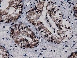 SQSTM1 Monoclonal Antibody (OTI1E9), TrueMAB , OriGene 30 &mu;L; Unconjugated:Antibodies,