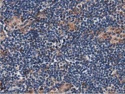 SQSTM1 Monoclonal Antibody (OTI1E9), TrueMAB , OriGene 30 &mu;L; Unconjugated:Antibodies,