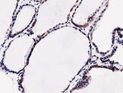 SQSTM1 Mouse anti-Human, Clone: OTI5A2, lyophilized, TrueMAB 100 &mu;g;