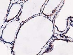 SQSTM1 Monoclonal Antibody (OTI5A2), TrueMAB , OriGene 30 &mu;L; Unconjugated:Antibodies,