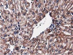SQSTM1 Mouse anti-Human, Clone: OTI5A2, lyophilized, TrueMAB 100 &mu;g;