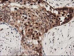 SQSTM1 Mouse anti-Human, Clone: OTI4G9, lyophilized, TrueMAB 100 &mu;g | Buy Online | Origene Technologies | Fisher Scientific