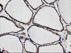 SQSTM1 Mouse anti-Human, Clone: OTI4G9, lyophilized, TrueMAB 100 &mu;g | Buy Online | Origene Technologies | Fisher Scientific