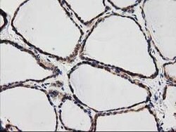 SQSTM1 Monoclonal Antibody (OTI4G9), TrueMAB , OriGene 30 &mu;L | Buy Online | OriGene | Fisher Scientific