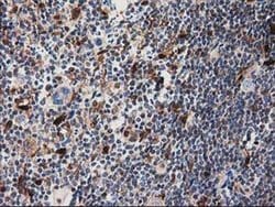 SQSTM1 Monoclonal Antibody (OTI4G9), TrueMAB , OriGene 30 &mu;L | Buy Online | OriGene | Fisher Scientific