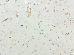 SQSTM1 Mouse anti-Human, Clone: UMAB13, liquid, UltraMAB 30 &mu;L | Buy Online | Origene Technologies | Fisher Scientific