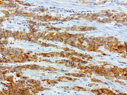 SQSTM1 Mouse anti-Human, Clone: UMAB13, liquid, UltraMAB 30 &mu;L | Buy Online | Origene Technologies | Fisher Scientific