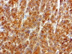 SQSTM1 Mouse anti-Human, Clone: UMAB13, liquid, UltraMAB 30 &mu;L | Buy Online | Origene Technologies | Fisher Scientific