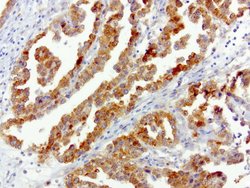 SQSTM1 Mouse anti-Human, Clone: UMAB13, liquid, UltraMAB 30 &mu;L | Buy Online | Origene Technologies | Fisher Scientific