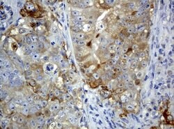 SQSTM1 Mouse anti-Human, Clone: UMAB13, liquid, UltraMAB 30 &mu;L | Buy Online | Origene Technologies | Fisher Scientific