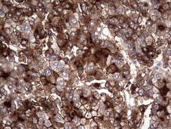 SQSTM1 Mouse anti-Human, Clone: UMAB13, liquid, UltraMAB 30 &mu;L | Buy Online | Origene Technologies | Fisher Scientific