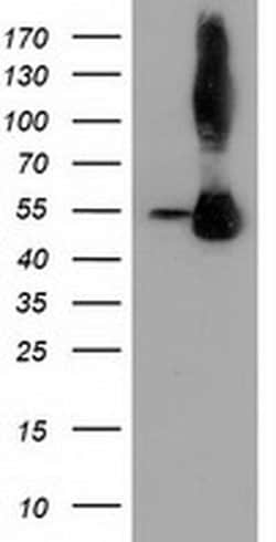 SQSTM1 Monoclonal Antibody (OTI1E9), TrueMAB , OriGene 30 &mu;L; Unconjugated:Antibodies,