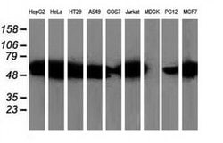 SQSTM1 Monoclonal Antibody (OTI1E9), TrueMAB , OriGene 30 &mu;L; Unconjugated:Antibodies,